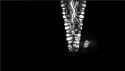 Closure - PS3